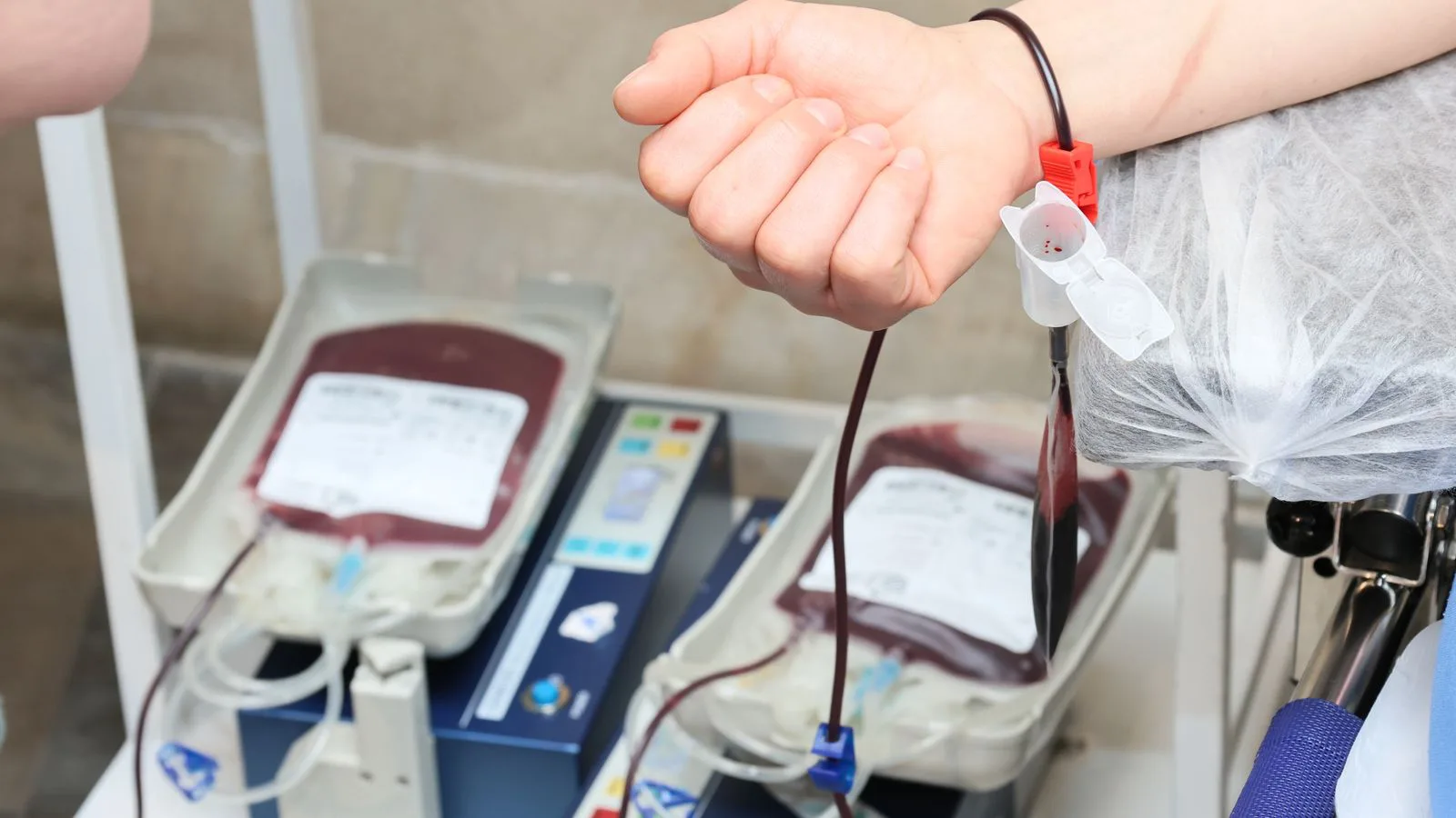 A donor's arm during a blood donation, collection bags below.