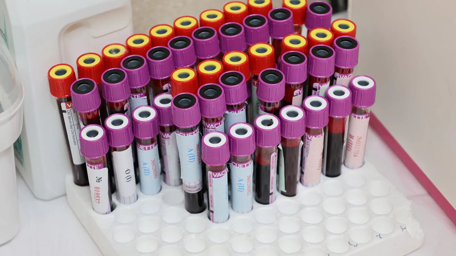 Rows of blood collection tubes in a laboratory rack.